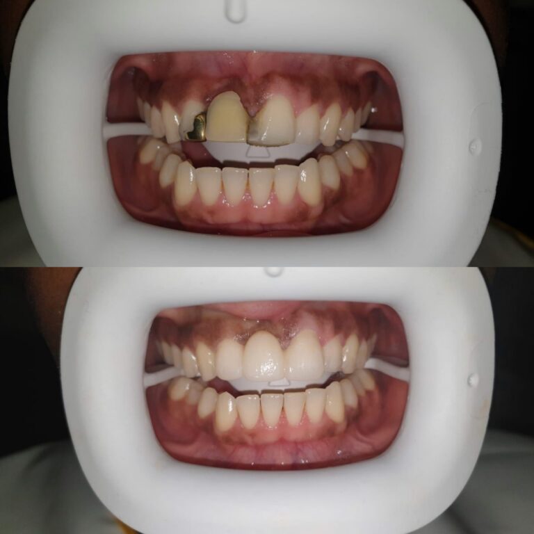 Collage_20250625_191835