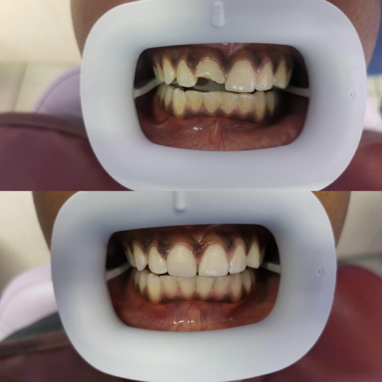 Collage_20250625_191910