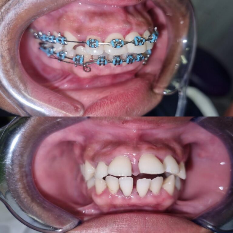 Collage_20250625_192002