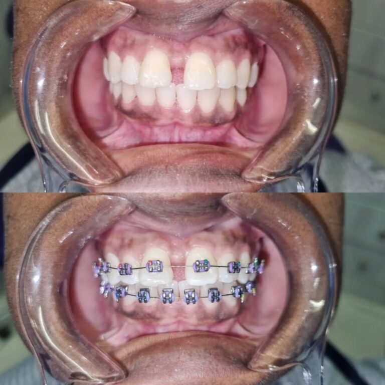 Collage_20250707_212230