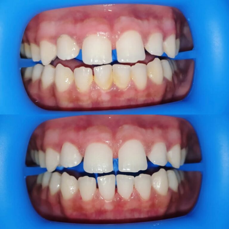 Collage_20250707_212636