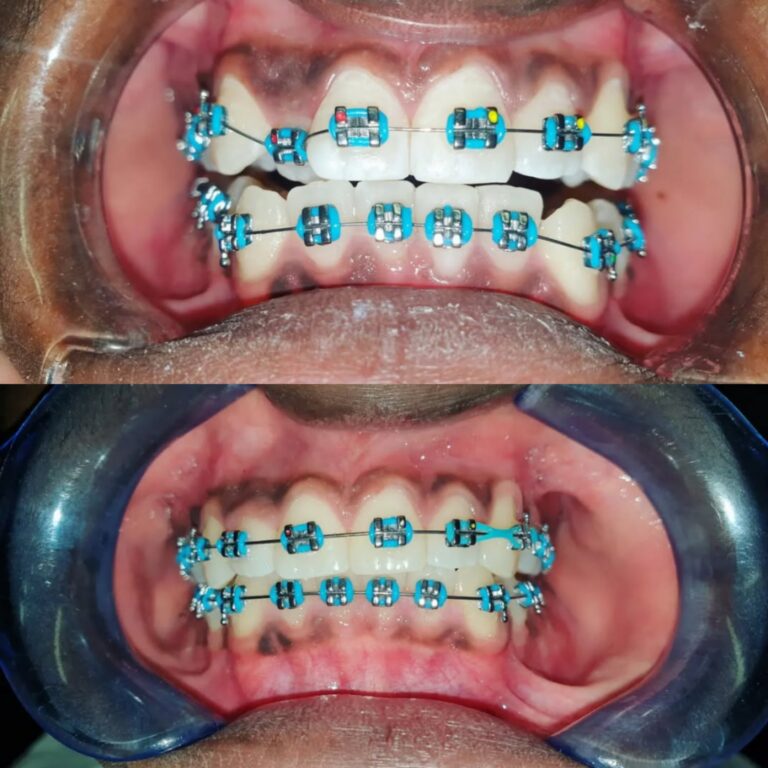 Collage_20250707_213221